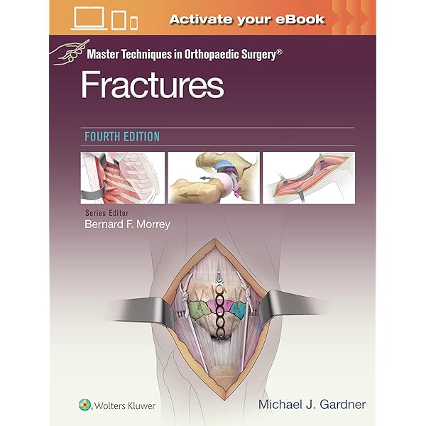 Amazon | Harborview Illustrated Tips and Tricks in Fracture